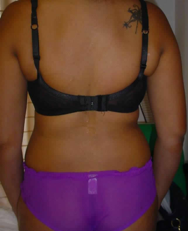 after ultrasound